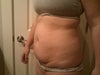 Standing Straight/Side View