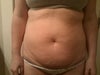 Stomach/Forward View