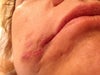 Ouch!