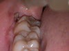 This is the side that's been in pain.