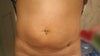 Belly