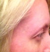 right brow