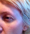 left brow