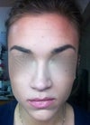 Excuse the weird eye blurring, but this photo shows the asymmetry in my nose