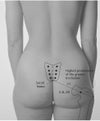 Indented hips
