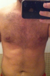 after (3.5 weeks)