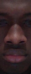 Frontal view