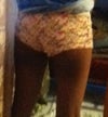 Dark legs