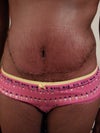 Highest scar that I have seen on anyone's picture. Do these occur at all?