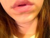 I'm over-exaggeratedly relaxing my lips here to show the W, but do you see it under my lower lip? Is this normal?