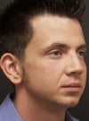 This is what I want to AVOID. He had cheek implants, leading to a rounder, fuller, and more feminine appearance in the midface. I want my cheekbones to flare out like a male model's.