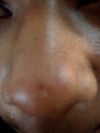 i have oily skin , please don't mind it