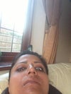 Aftery Surgery - Today