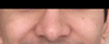 The right side appears swollen (for the viewer, it is the left side in the photo)