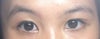 My left eyebrow makes an arch shape, making my left eye appear big and round
My right eyebrow doesn't make an arch shape which creates a distinct flat and droopy eye
