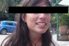 Before Nose Job I had a big nose, I just want it to straighten it, not to get it smaller...