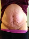 My belly and still 8 pounds to go to get to pre preg weight.