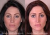 Here you can see the change of eyes in front view.
