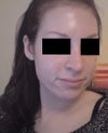 real nose