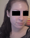 edited nose - how I would like it to look