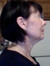side view
