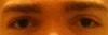 left eye on right side