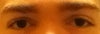 left eye on right side