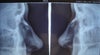 X-Ray Sides