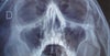 X-Ray Front