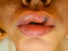 yes i am pouting, but they really did look lovely..despite the bruising:(
