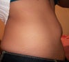 Sideview of stomach