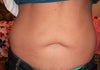 Front view of stomach