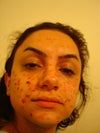My face on day 2