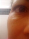 Righ eye