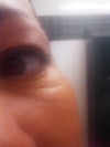 Left eye