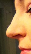 I have a hump that I didn't have when I was younger. Its not that bad though.