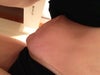 3 months post op... Bending