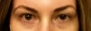L eye