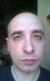 Before Surgery (2012)