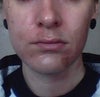 Please excuse the discoloration on my skin, this picture was taken just after having a skin treatment.
