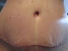 White line lower tummy