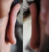 Back of ears