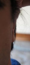 Front of left ear