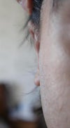 Front of right ear