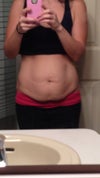 This pic is night before surgery (6kids later)