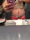 This pic 7 days after full TT /MR