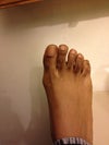Right foot