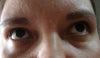Tired eyes