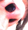 What is my next step if the plastic holding my nasal septum holding my skin pokes out from the inside of my nose?or i'm i mistaken?