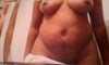 Before front view Tummy Tuck